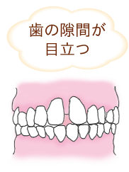 あなたの歯並びはどれですか その悪い原因 治療方法を比較